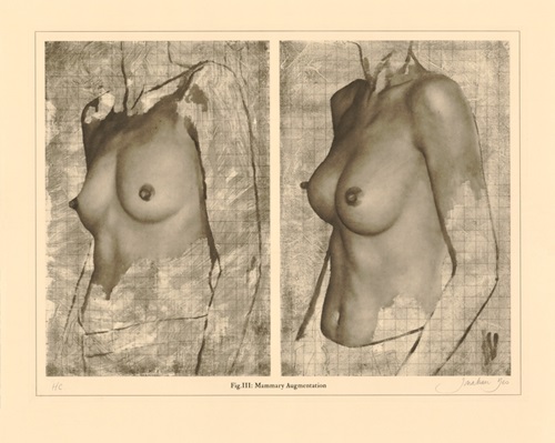 Mammary Augmentation  by Jonathan Yeo